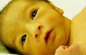 apakah berbahaya penyakit kuning pada bayi