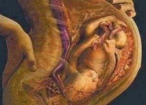 ciri ciri ibu hamil mengandung bayi perempuan